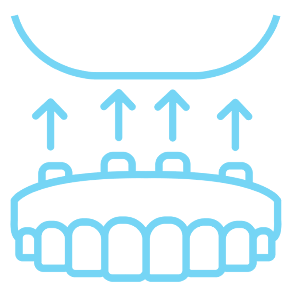 implant supported denture