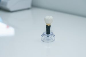 Consultation with dentist about dental implants in a modern clinic.