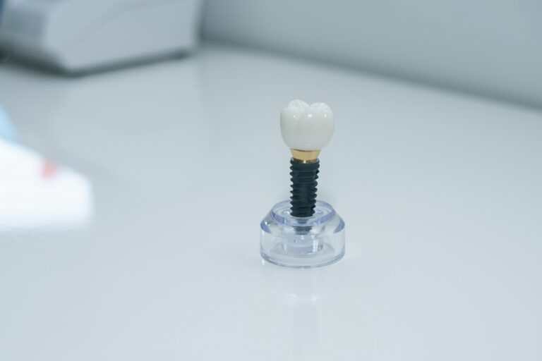 Consultation with dentist about dental implants in a modern clinic.
